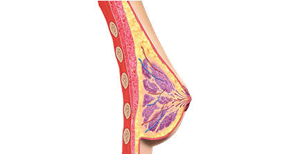 Breast Reconstruction
