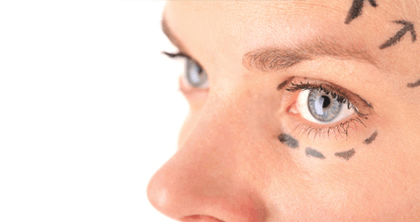 Eyelid Procedures