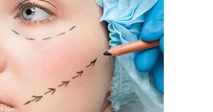 Face lift and Neck lift
