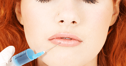 Lip Augmentation