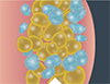 In the weeks that follow, your body naturally eliminates dead fat cells.*